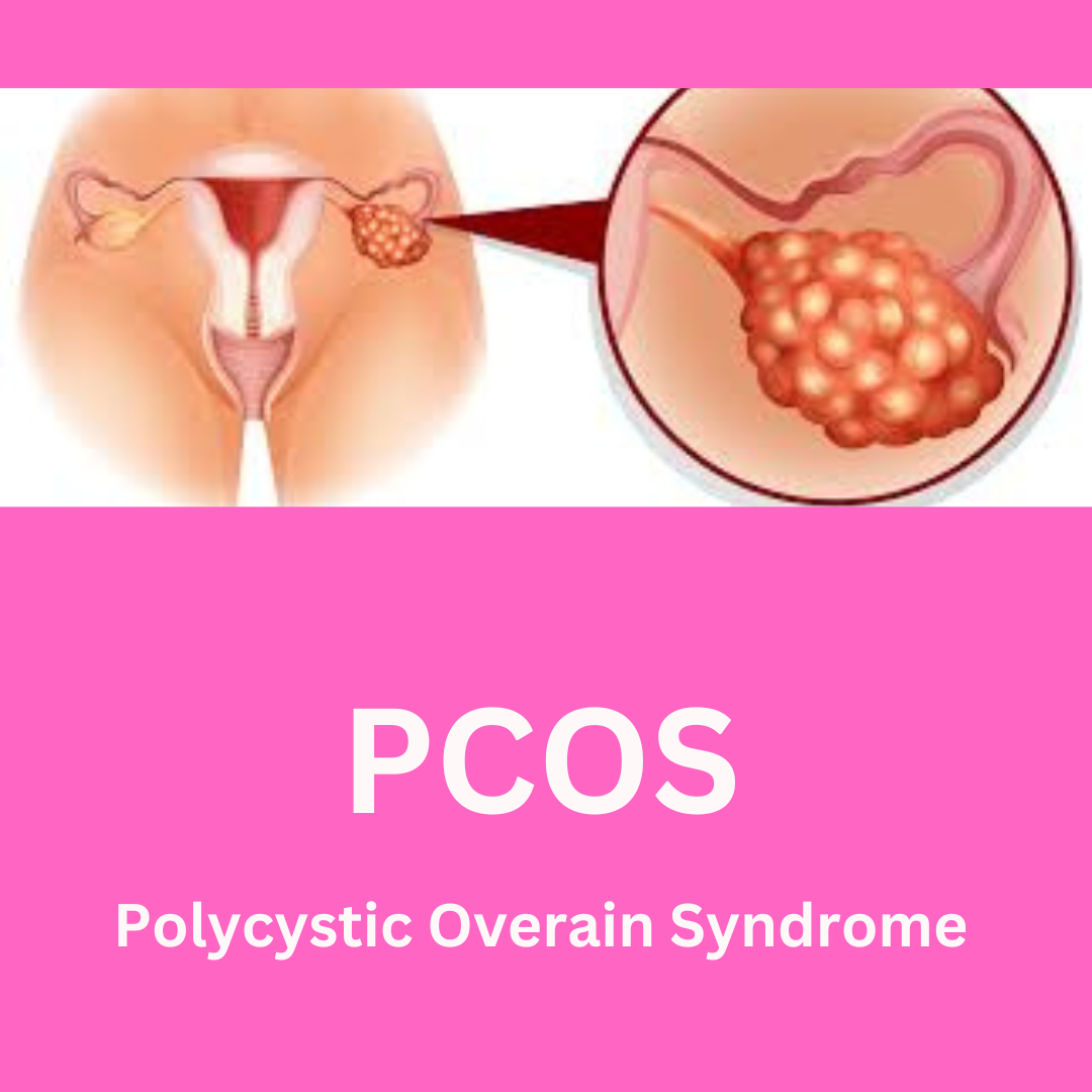Raising Awareness About PCOS